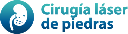 Cirugía láser de piedras