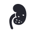 Urolitiasis (Piedras en la Vía Urinaria)